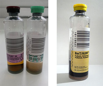 bact alert blood culture bottles